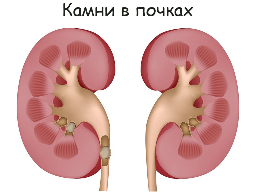 Кракен торговая площадка даркнет